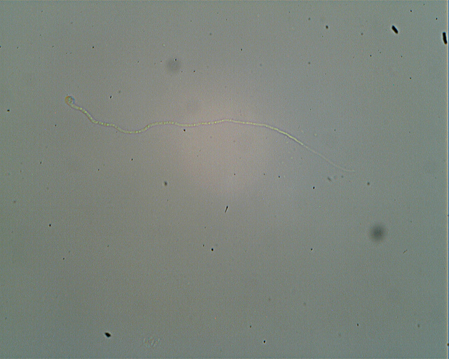 Asterostroma laxum Bres. (1920)